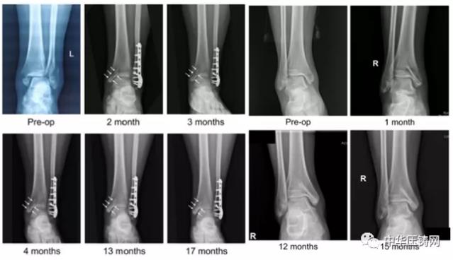 【特訊】銀光鎂業擬新增40臺鎂合金精密加工生產線；博格華納將為日產汽車供應分動箱；德威科技開年簽訂國際鎂輪轂生產訂單
